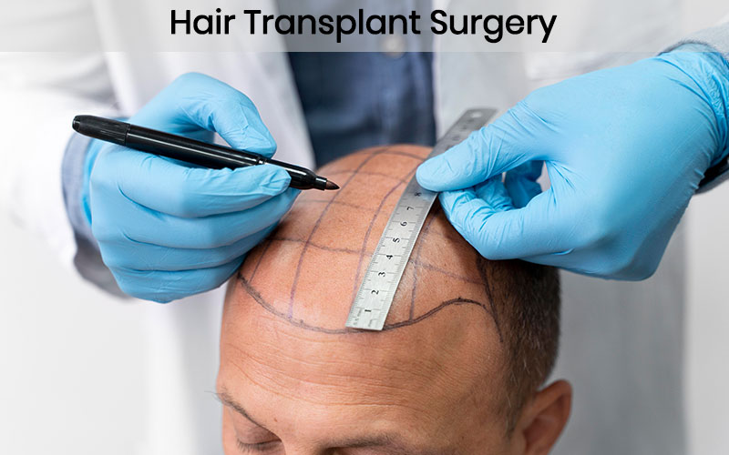 hair-transplant-surgery-clinic-chennai-1